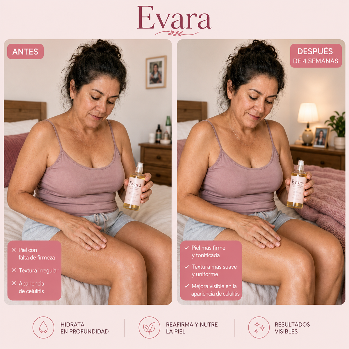 Piel más firme | Hidratada en 4 semanas con Evara®